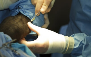 equine-anesthesia