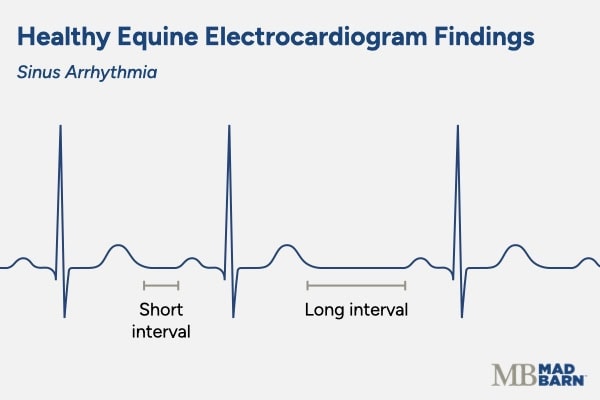 equine ecg graph showing sinus arrhythmia