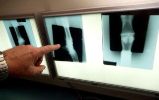 fractures-in-equine-medicine