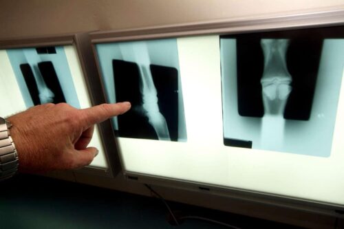fractures-in-equine-medicine